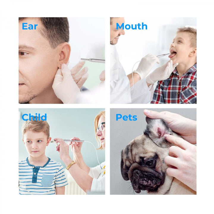 Digital Otoscope with 4.5 Inches Screen, 3.9mm Ear Camera with 6 LED Lights, 32GB Card, Ear Wax Removal Tool, Specula and 2600 mAh Rechargeable Battery, Supports Photo Snap and Video Recording